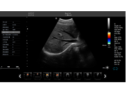 b超儀器監(jiān)測(cè)圖像