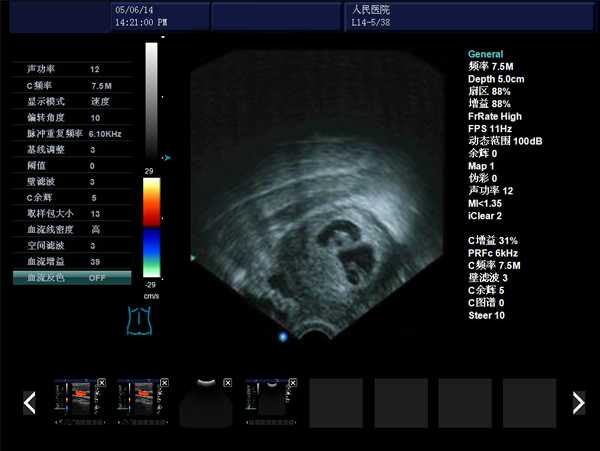 婦產(chǎn)科b超儀