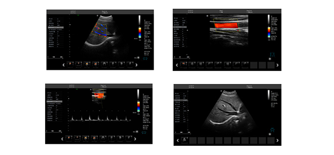 彩超機(jī)臨床圖