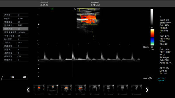 彩超機檢測圖