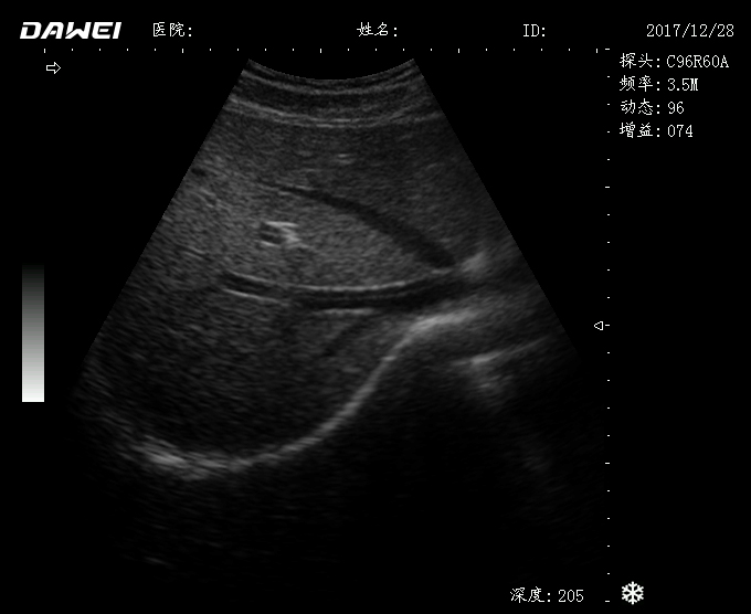 黑白B超機檢測圖