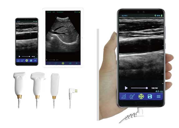 掌上超聲設(shè)備
